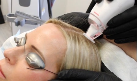 Needle-Free Platelet-Rich Plasma Grows Hair Through Thulium Laser Technology  - Regeneris Medspa & Cosmetic Surgery